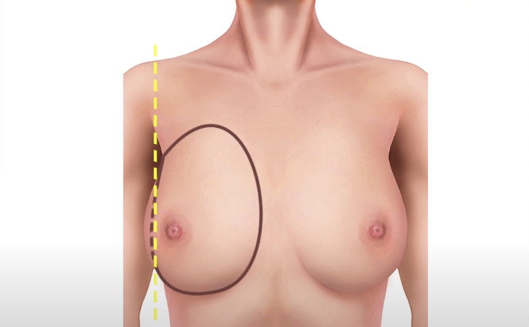 ขอบเขตด้านนอก