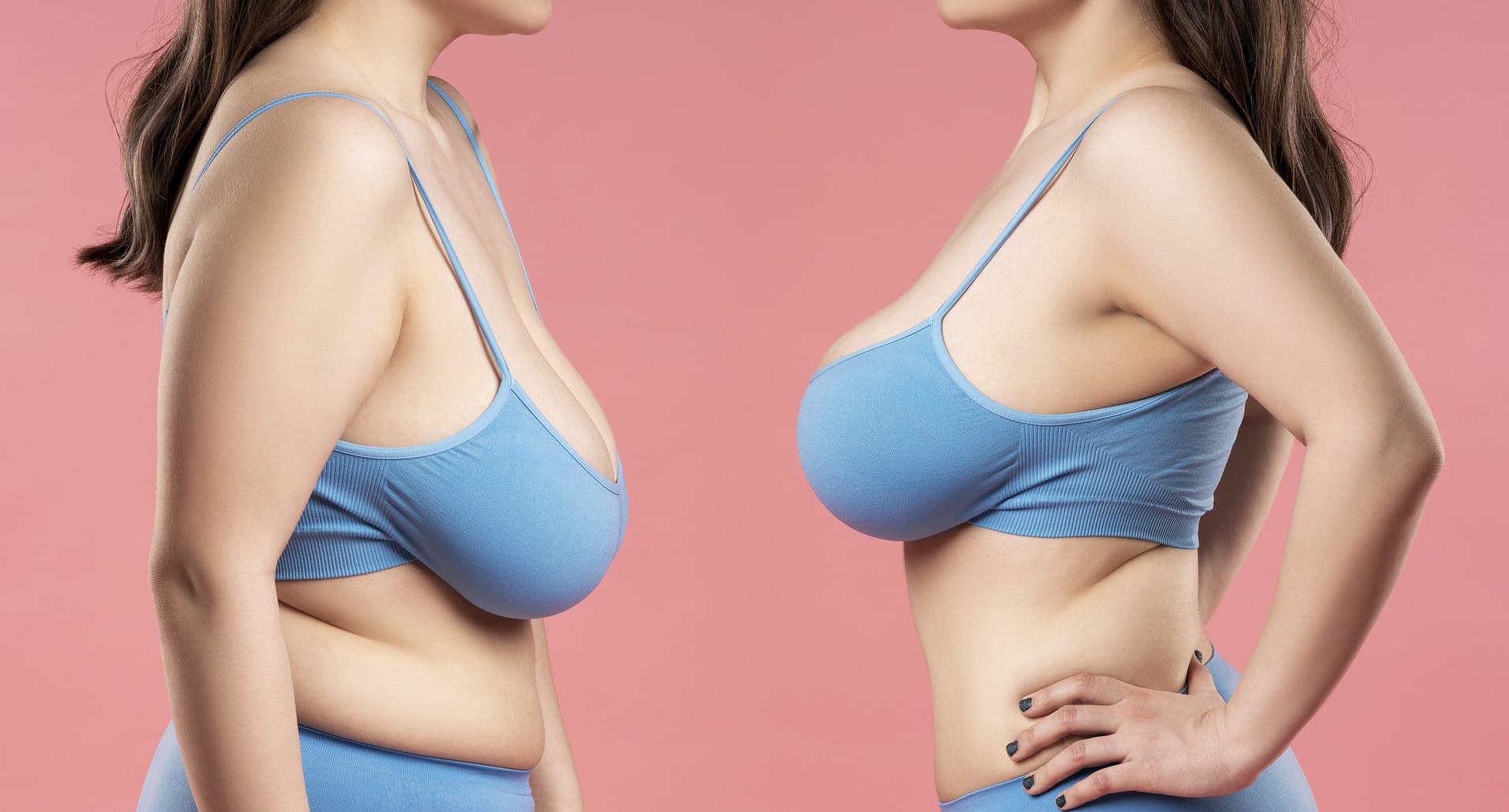 ลดขนาดหน้าอก และยกกระชับหน้าอก