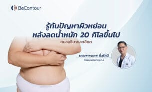 ผิวหนังหย่อนคล้อยหลังลดน้ำหนัก
