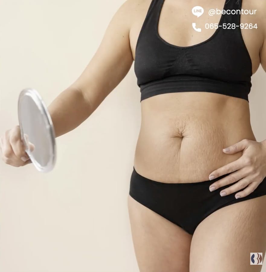 Massive Weight Loss คืออะไร และเกิดอะไรขึ้นกับร่างกาย?